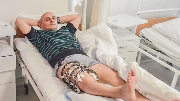 Пораненому під Іловайськом бійцю відновили розтрощену ногу