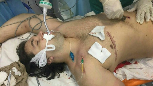 Зявився стопкадр із камери вбитого патрульного