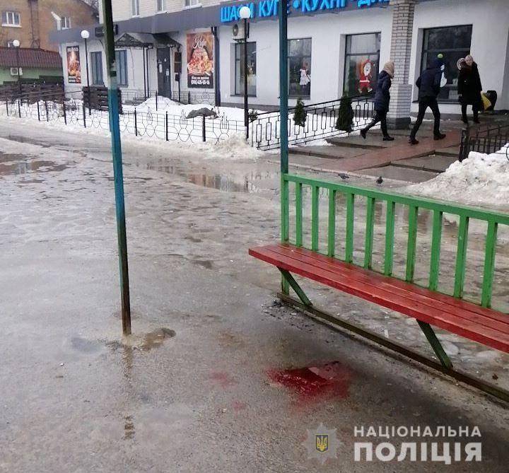 В Броварах мужчина после ссоры с девушкой выстрелил в голову прохожей
